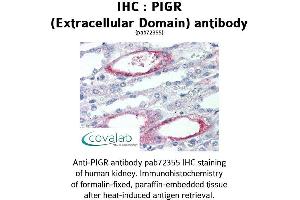 Image no. 1 for anti-Polymeric Immunoglobulin Receptor (PIGR) (Extracellular Domain) antibody (ABIN1738097)