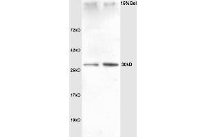 Lane 1: rat heart Lane 2: rat liver lysates probed with Anti SNAI2/SLUG Polyclonal Antibody, Unconjugated (ABIN685747) at 1:200 in 4 °C. (SLUG anticorps  (AA 5-120))