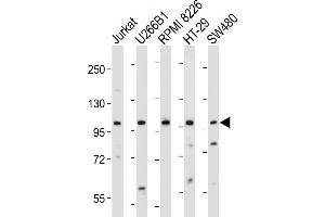 All lanes : Anti-NLRP6 Antibody (N-term) at 1:2000 dilution Lane 1: Jurkat whole cell lysate Lane 2: U266B1 whole cell lysate Lane 3: RI 8226 whole cell lysate Lane 4: HT-29 whole cell lysate Lane 5: S whole cell lysate Lysates/proteins at 20 μg per lane.
