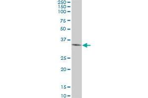 DKK1 monoclonal antibody (M01), clone 4D4. (DKK1 anticorps  (AA 81-180))