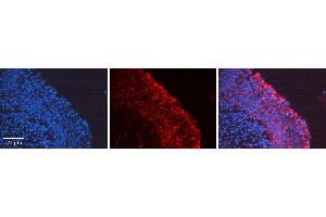 Rabbit Anti-PTK2 Antibody Catalog Number: ARP70875_P050 Formalin Fixed Paraffin Embedded Tissue: Human Urinary Bladder Tissue Observed Staining: Plasma membrane, Cytoplasm Primary Antibody Concentration: 1:100 Other Working Concentrations: N/A Secondary Antibody: Donkey anti-Rabbit-Cy3 Secondary Antibody Concentration: 1:200 Magnification: 20X Exposure Time: 0.
