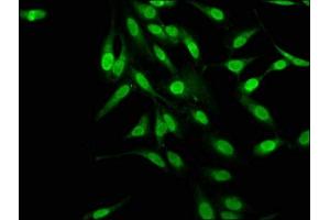 Immunofluorescence staining of Hela cells with ABIN7159296 at 1:145, counter-stained with DAPI.