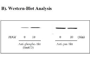 Image no. 3 for V-Akt Murine Thymoma Viral Oncogene Homolog 1 (AKT1) ELISA Kit (ABIN625233) (AKT1 Kit ELISA)