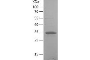Western Blotting (WB) image for Ureidopropionase, beta (UPB1) (AA 289-384) protein (His-IF2DI Tag) (ABIN7125659)
