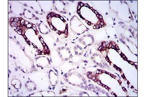 Immunohistochemistry (IHC) image for anti-Bone Morphogenetic Protein Receptor 1A (BMPR1A) (AA 179-378) antibody (ABIN1845272) (BMPR1A anticorps  (AA 179-378))