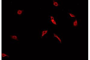 ABIN6269213 staining A549 cells by IF/ICC. (CDC25B anticorps  (Internal Region))
