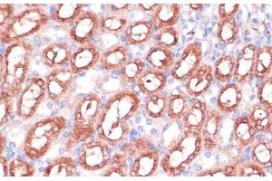 Immunohistochemistry of paraffin-embedded Mouse kidney using SHMT1 Polyclonal Antibody at dilution of 1:100 (40x lens).