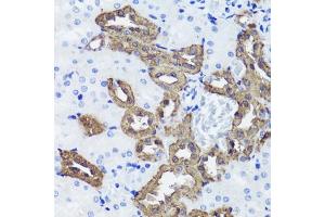 Immunohistochemistry of paraffin-embedded rat kidney using Calbindin antibody (ABIN6134603, ABIN6137847, ABIN6137848 and ABIN6213988) at dilution of 1:100 (40x lens). (CALB1 anticorps  (AA 1-261))