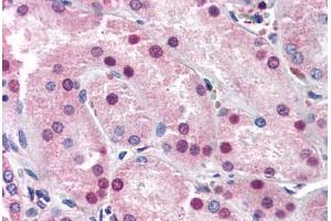 Human Kidney (formalin-fixed, paraffin-embedded) stained with NR1I3 antibody ABIN337348 at 10-20 ug/ml followed by biotinylated goat anti-rabbit IgG secondary antibody ABIN481713, alkaline phosphatase-streptavidin and chromogen. (NR1I3 anticorps  (N-Term))