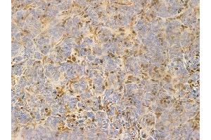 anti-Ubiquitin Protein Ligase E3 Component N-Recognin 5 (UBR5) (N-Term) antibody