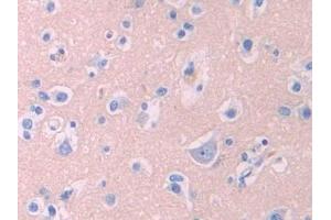 Detection of LCAT in Human Cerebrum Tissue using Polyclonal Antibody to Lecithin Cholesterol Acyltransferase (LCAT) (LCAT anticorps  (AA 290-433))