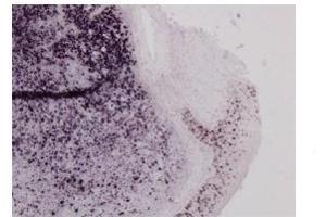 Sample Type:  Human Tonsil TissuePrimary   Dilution:  1ug/mL (MSH6 anticorps  (N-Term))
