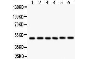 Lane 5: PANC Whole Cell Lysate at 40ug Lane 6: HEPG2 Whole Cell Lysate at 40ug Predicted bind size: 48KD Observed bind size: 48KD