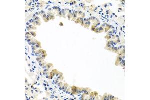 Immunohistochemistry of paraffin-embedded mouse lung using BMP5 antibody.
