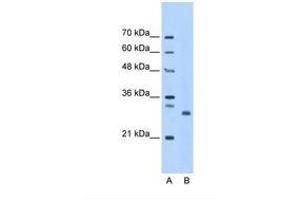 Image no. 1 for anti-PSMC3 Interacting Protein (PSMC3IP) (AA 143-192) antibody (ABIN321308) (PSMC3IP anticorps  (AA 143-192))