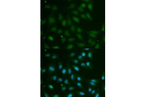 Immunofluorescence analysis of MCF-7 cells using ABO antibody (ABIN5970766). (ABO anticorps)