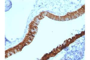 Formalin-fixed, paraffin-embedded human Ovary stained with Cytokeratin 3 Mouse Monoclonal Antibody (KRT3/2130). (Keratin 3 anticorps)