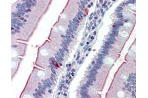 Immunohistochemistry (Formalin/PFA-fixed paraffin-embedded sections) of human small intestine with SLC5A1 polyclonal antibody .