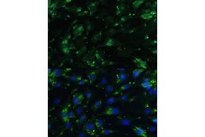 Immunofluorescence analysis of C6 cells using CGRP antibody (ABIN6128310, ABIN6137852, ABIN6137855 and ABIN6221187) at dilution of 1:100.