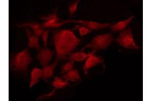 ABIN6268997 staining HuvEc by IF/ICC.