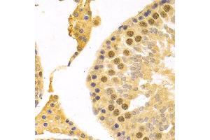 Immunohistochemistry of paraffin-embedded rat testis using RFC4 Antibody.