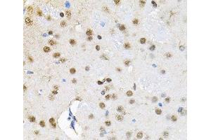 Immunohistochemistry of paraffin-embedded Rat brain using BAF60a Polyclonal Antibody at dilution of 1:100 (40x lens). (SMARCD1 anticorps)