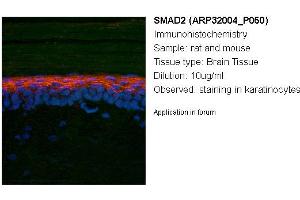 Image no. 2 for anti-SMAD, Mothers Against DPP Homolog 2 (SMAD2) (N-Term) antibody (ABIN2779412) (SMAD2 anticorps  (N-Term))