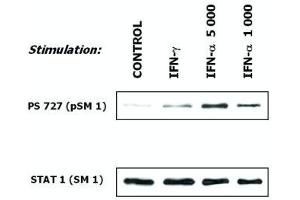 Induction of phosphorylation of STAT1 (Western Blotting) Fig. (STAT1 anticorps)