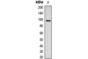 Western blot analysis of CD18 expression in HEK293T (A) whole cell lysates. (Integrin beta 2 anticorps  (Center))