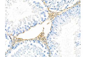 ABIN6259135 and ABIN6275366 at 1/100 staining Rat testis tissue by IHC-P. (nectin-3 anticorps  (Internal Region))
