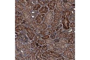 Immunohistochemical staining of human kidney with TRIM7 polyclonal antibody  shows strong cytoplasmic positivity in tubular cells at 1:200-1:500 dilution. (TRIM7 anticorps)