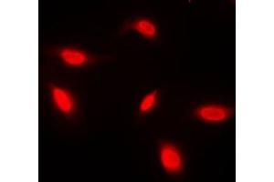 Immunofluorescent analysis of ANAPC1 staining in HeLa cells.