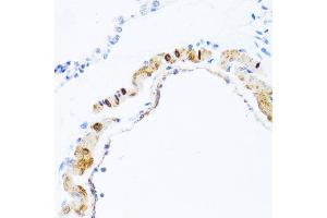 Immunohistochemistry of paraffin-embedded rat lung using PHPT1 antibody (ABIN5970475) at dilution of 1/100 (40x lens).