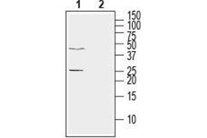 Western blot analysis of human LNCaP prostate adenocarcinoma cell line lysate: - 1.
