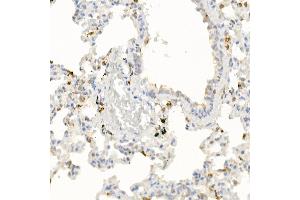 Immunohistochemistry of paraffin-embedded rat lung using IL21 Rabbit pAb (ABIN6128086, ABIN6142359, ABIN6142360 and ABIN6223071) at dilution of 1:50 (40x lens). (IL-21 anticorps  (AA 25-162))