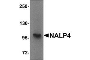 Western blot analysis of NALP4 in K562 cell lysate with NALP4 antibody at 1 μg/ml. (NLRP4 anticorps  (Center))
