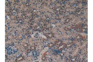 IHC-P analysis of Rat Kidney Tissue, with DAB staining. (MT-ND5 anticorps  (AA 425-562))