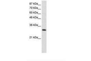 anti-AIMP1 / EMAP II (AA 31-80) antibody