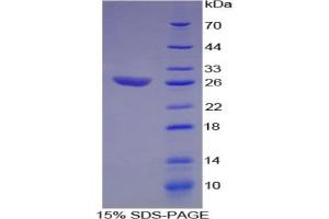 SDS-PAGE analysis of Human ATF1 Protein. (AFT1 Protéine)