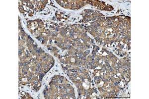 IHC analysis of FADS1 using anti-FADS1 antibody (ABIN7599175).