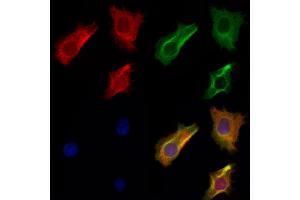 ABIN6263924 and ABIN6272926 staining Hela cells by IF/ICC.