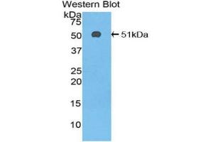 Western blot analysis of the recombinant protein. (SERPINC1 anticorps  (AA 33-465))