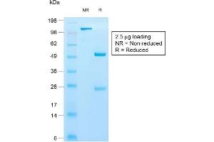 SDS-PAGE Analysis of Purified Cytokeratin 10 Rabbit Recombinant Monoclonal Antibody (KRT10/1990R).
