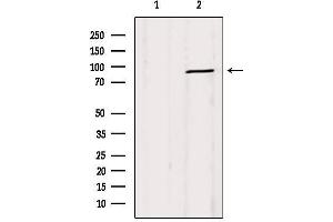 Western blot analysis of extracts from Mouse lung, using DRP1  Antibody.