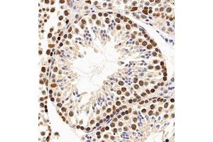 Immunohistochemistry of paraffin embedded mouse testis using PP4R2 (ABIN7075284) at dilution of 1:2000 (400x lens)