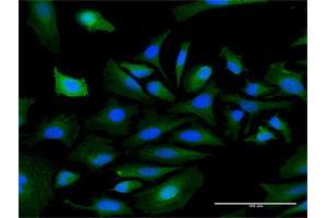 Immunofluorescence of purified MaxPab antibody to PKNOX1 on HeLa cell. (PKNOX1 anticorps  (AA 1-436))