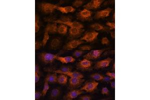 Immunofluorescence analysis of C6 cells using [KO] IFITM3 antibody (ABIN6130482, ABIN6142186, ABIN6142187 and ABIN7101416) at dilution of 1:100. (IFITM3 anticorps  (AA 1-133))