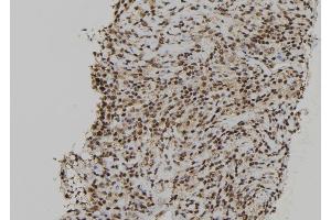 ABIN6264680 and ABIN6272412 at 1/100 staining Human spleen tissue by IHC-P.