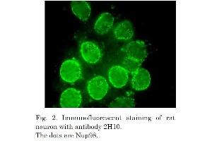 Immunofluorescence (IF) image for anti-Nucleoporin 98kDa (NUP98) (AA 1-466) antibody (ABIN2452066) (NUP98 anticorps  (AA 1-466))