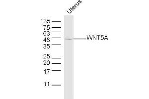Mouse uterus lysates probed with WNT5A Polyclonal Antibody, unconjugated  at 1:300 overnight at 4°C followed by a conjugated secondary antibody at 1:10000 for 90 minutes at 37°C.